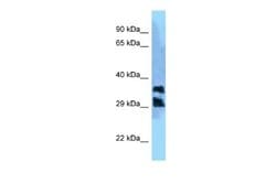 PGPase Rabbit anti-Human, Polyclonal, Novus Biologicals 0.1 mL | Buy Online | Novus Biologicals | Fisher Scientific